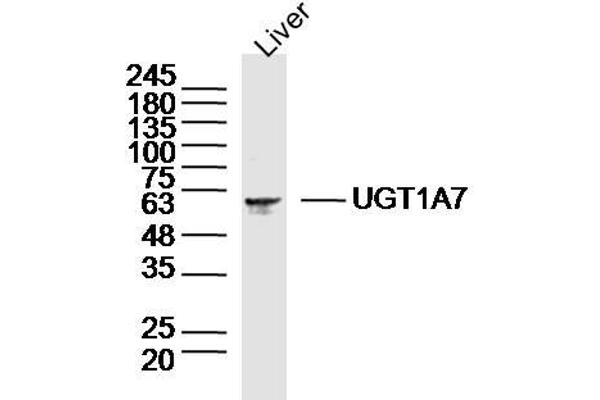 UGT1A7 Antikörper  (AA 431-531)