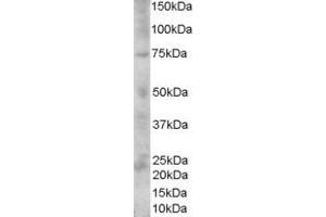 ABIN185660 (1µg/ml) staining of Human Skin lysate (35µg protein in RIPA buffer). (Melanoma gp100 抗体  (C-Term))