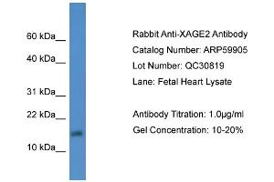 WB Suggested Anti-XAGE2  Antibody Titration: 0. (XAGE2 抗体  (Middle Region))