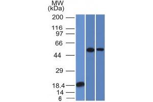 Western Blot Analysis (A) Recombinant protein (B) A549 (C) A431 TOX3 Mouse Monoclonal Antibody (TOX3/1124). (TOX3 抗体  (AA 251-389))