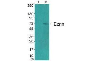 Western blot analysis of extracts from COS7 cells (Lane 2), using Ezrin (Ab-478) antiobdy.