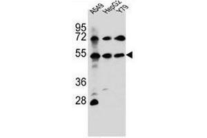 FGFRL1 Antibody (N-term) western blot analysis in A549,HepG2,Y79 cell line lysates (35µg/lane). (FGFRL1 抗体  (N-Term))
