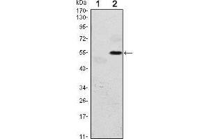 Western blot analysis using EIF2AK3 mAb against HEK293 (1) and EIF2AK3(AA: 929-1116)-hIgGFc transfected HEK293 (2) cell lysate.