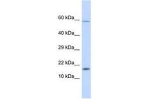 Image no. 1 for anti-Hect Domain and RLD 4 (HERC4) (AA 39-76) antibody (ABIN6746210) (HERC4 抗体  (AA 39-76))