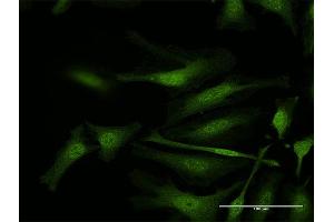 Immunofluorescence of purified MaxPab antibody to IFI35 on HeLa cell. (IFI35 抗体  (AA 1-288))