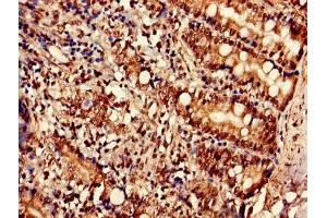 Immunohistochemistry of paraffin-embedded human small intestine tissue using ABIN7170231 at dilution of 1:100 (SLC35F2 抗体  (AA 335-374))