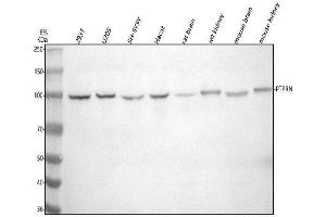 Western blot analysis of IA-2/PTPRN using anti-IA-2/PTPRN antibody (ABIN7601431).