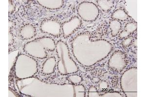 Immunoperoxidase of purified MaxPab antibody to ILF2 on formalin-fixed paraffin-embedded human thyroid nodular goiter. (ILF2 抗体  (AA 1-390))