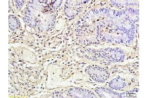 Formalin-fixed and paraffin embedded rat colon labeled with Anti-CD177/NB1 Polyclonal Antibody, Unconjugated (ABIN687187) followed by conjugation to the secondary antibody and DAB staining (CD177 抗体  (AA 521-650))