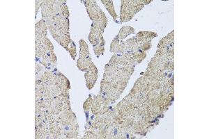 Immunohistochemistry of paraffin-embedded mouse heart using HBA2 antibody at dilution of 1:100 (x40 lens). (HBa2 抗体)