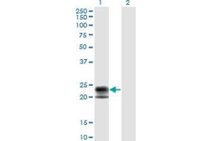 Western Blot analysis of TNFRSF17 expression in transfected 293T cell line by TNFRSF17 monoclonal antibody (M01), clone 1F10. (BCMA 抗体  (AA 1-184))