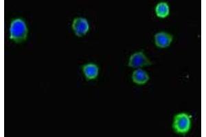 Immunofluorescent analysis of HepG2 cells using ABIN7158488 at dilution of 1:100 and Alexa Fluor 488-congugated AffiniPure Goat Anti-Rabbit IgG(H+L) (LONP1 抗体  (AA 614-959))
