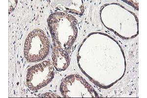 Image no. 4 for anti-Chromosome X Open Reading Frame 26 (CXorf26) antibody (ABIN1497690) (CXorf26 抗体)