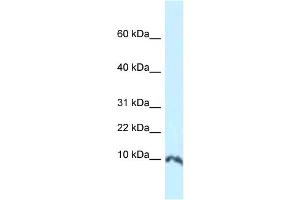 WB Suggested Anti-Sumo1 Antibody   Titration: 1. (SUMO1 抗体  (N-Term))