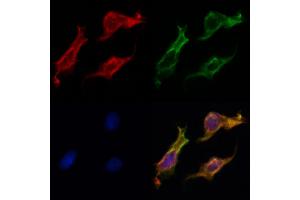 ABIN6262775 and ABIN6269025 staining HepG2 by IF/ICC. (KRT16 抗体  (C-Term))