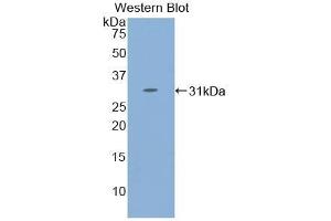 Detection of Recombinant STAT4, Human using Polyclonal Antibody to Signal Transducer And Activator Of Transcription 4 (STAT4) (STAT4 抗体  (AA 505-737))