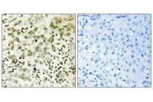 Immunohistochemistry (IHC) image for anti-CTD (Carboxy-terminal Domain, RNA Polymerase II, Polypeptide A) Small Phosphatase 1 (CTDSP1) (N-Term) antibody (ABIN7184440)