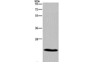 Western Blot analysis of Mouse heart tissue using CMTM5 Polyclonal Antibody at dilution of 1:400 (CMTM5 抗体)