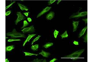 Immunofluorescence (IF) image for anti-Tubulin, alpha 4a (TUBA4A) (AA 1-448) antibody (ABIN521139)