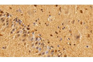 Detection of S100B in Bovine Cerebellum Tissue using Polyclonal Antibody to S100 Calcium Binding Protein B (S100B) (S100B 抗体  (AA 1-92))