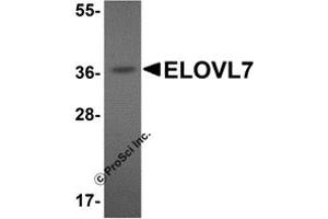 Western Blotting (WB) image for anti-ELOVL Fatty Acid Elongase 7 (ELOVL7) (N-Term) antibody (ABIN1031366) (ELOVL7 抗体  (N-Term))