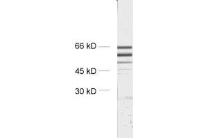 dilution: 1 : 2000, sample: crude synaptosomal fraction of rat brain (P2) (STXBP2 抗体)
