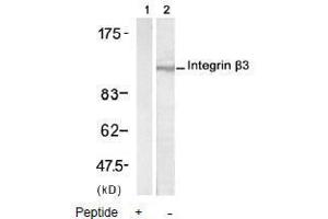 Image no. 2 for anti-Integrin beta 3 (ITGB3) (AA 771-775) antibody (ABIN197246) (Integrin beta 3 抗体  (AA 771-775))
