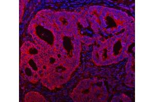 anti-Transmembrane Channel-Like 7 (TMC7) (AA 8-723) antibody