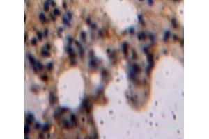IHC-P analysis of Lung tissue, with DAB staining. (LIFR 抗体  (AA 522-691))