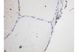 Image no. 3 for anti-Glyceraldehyde-3-Phosphate Dehydrogenase, Spermatogenic (GAPDHS) antibody (ABIN1498375)