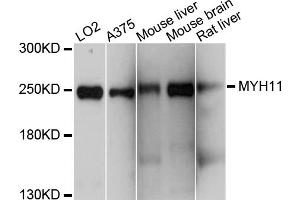 Western blot analysis of extracts of various cell lines, using MYH11 antibody (ABIN4904464) at 1:1000 dilution. (MYH11 抗体)