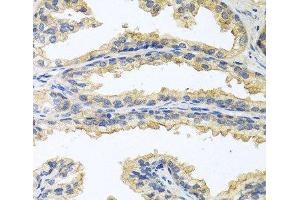 Immunohistochemistry of paraffin-embedded Human prostate using OSM Polyclonal Antibody at dilution of 1:100 (40x lens). (Oncostatin M 抗体)