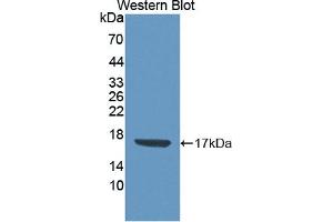 Detection of Recombinant CDA, Human using Polyclonal Antibody to Cytidine Deaminase (CDA) (CDA 抗体  (AA 2-146))