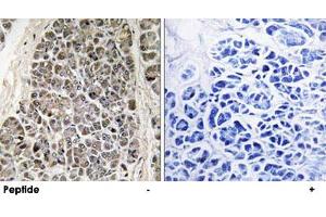 Immunohistochemistry analysis of paraffin-embedded human pancreas tissue using MRPS21 polyclonal antibody . (MRPS21 抗体)