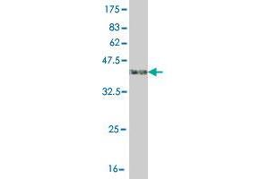 Western Blot detection against Immunogen (41. (ASK1 抗体  (AA 1231-1374))