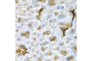 Immunohistochemistry of paraffin-embedded mouse liver using NCL antibody at dilution of 1:200 (40x lens). (Nucleolin 抗体)