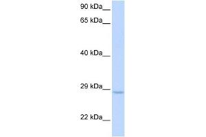 XRCC2 antibody used at 1 ug/ml to detect target protein. (XRCC2 抗体  (Middle Region))