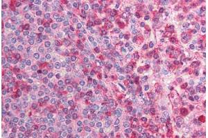Immunohistochemistry (Paraffin-embedded Sections) (IHC (p)) image for anti-Calcium Channel, Voltage-Dependent, beta 2 Subunit (CACNB2) (N-Term) antibody (ABIN6736360)