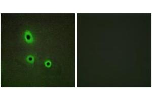 Immunofluorescence analysis of A549 cells, using EFNA5 Antibody. (Ephrin A5 抗体  (AA 31-80))