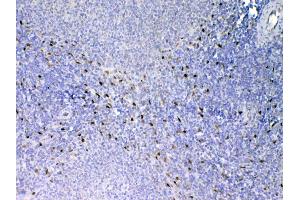 Immunohistochemistry (IHC) image for anti-Interleukin 33 (IL33) (AA 102-264) antibody (ABIN5692884)