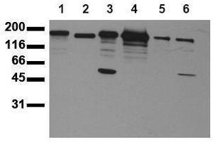 Western Blotting (WB) image for anti-Receptor tyrosine-protein kinase erbB-2 (ErbB2/Her2) (AA 1240-1260) antibody (ABIN126791) (ErbB2/Her2 抗体  (AA 1240-1260))