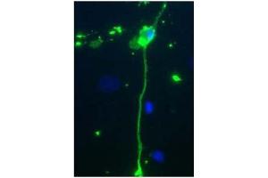 Rat mixed neuron/glial cultures stained with Chicken anti-MBP antibody (green). (MBP 抗体)