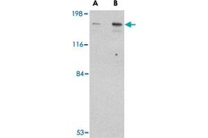 Western blot analysis of CLIP1 in rat brain tissue lysate with CLIP1 polyclonal antibody  at (A) 0. (CLIP1 抗体  (C-Term))