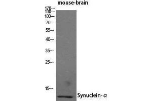 Western Blotting (WB) image for anti-Synuclein, alpha (SNCA) (N-Term) antibody (ABIN3187131) (SNCA 抗体  (N-Term))