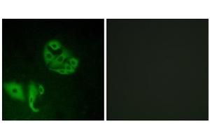 Immunofluorescence analysis of A549 cells, using GPR20 antibody. (GPR20 抗体  (C-Term))