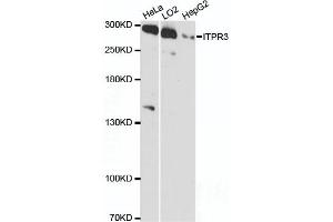 Western blot analysis of extracts of various cell lines, using ITPR3 antibody (ABIN6132120, ABIN6142616, ABIN6142617 and ABIN6216547) at 1:3000 dilution. (ITPR3 抗体  (AA 1630-1870))