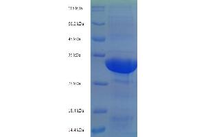 SDS-PAGE (SDS) image for Tripartite Motif Containing 24 (TRIM24) (AA 891-1012), (partial) protein (His-SUMO Tag) (ABIN5710552)