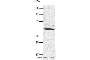 Western blot analysis of A549 cell, using SLC16A7 Polyclonal Antibody at dilution of 1:450 (SLC16A7 抗体)