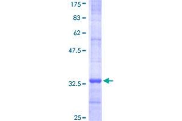 MGST3 Protein (AA 28-84) (GST tag)