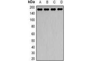 Western blot analysis of Dynactin 1 expression in Hela (A), HepG2 (B), mouse brain (C), mouse lung (D) whole cell lysates. (Dynactin 1 抗体)